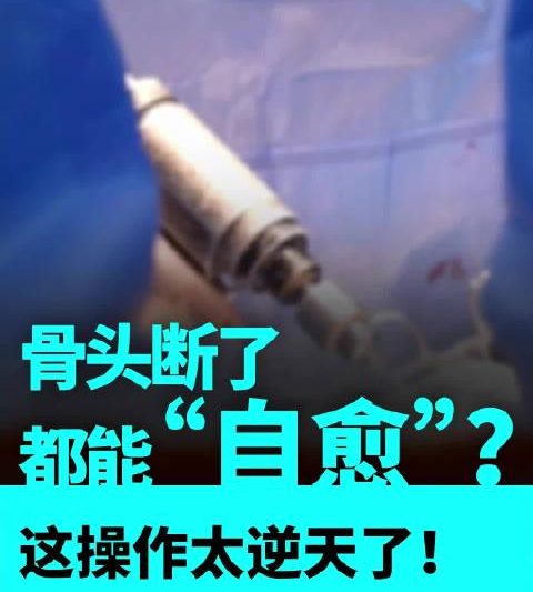 海外华人看不了央视3D打印骨技术？3招破解地区限制，医疗前沿零距离！