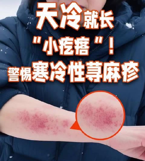 海外追剧党必看！3招破解地区限制，轻松解锁国内影视综艺