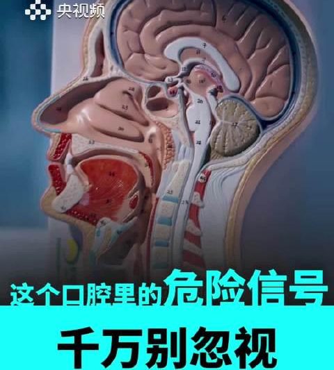 口腔溃疡反复发作别大意！这些日常习惯可能是癌变前兆，专家提醒早发现是关键