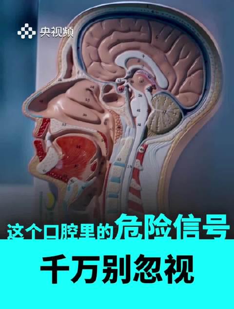 口腔溃疡反复发作别大意!这些日常习惯可能是癌变前兆,专家提醒早发现是关键