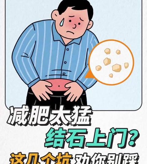 16+8减肥法暗藏风险？专家教你避开结石的5个饮食陷阱