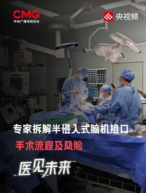 海外华人追剧听歌遇阻?别急!专家揭秘脑机接口手术,未来科技或解地区限制难题